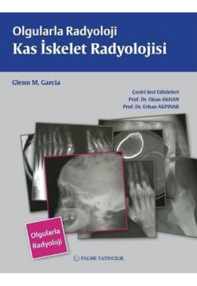 Olgularla Radyoloji / Kas İskelet  Radyolojisi