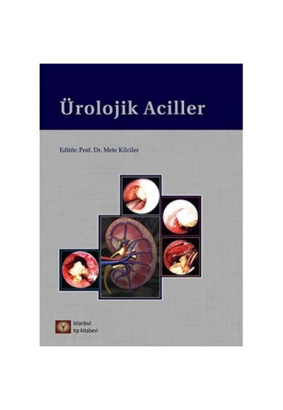 Ürolojik Aciller