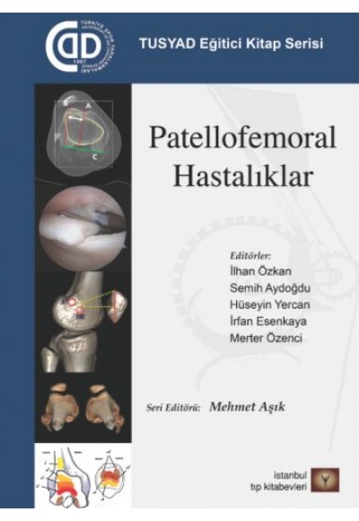 TUSYAD Eğitici Kitap Serisi - Patellofemoral Hastalıklar