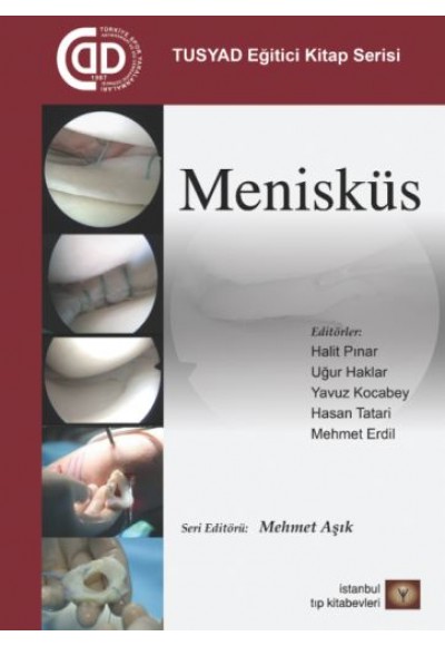 TUSYAD Eğitici Eğitim Seti - Menisküs