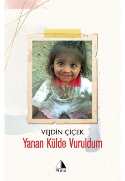 Yanan Külde Vuruldum