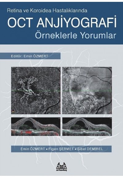 Retina ve Koroidea Hastalıklarında OCT Anjiyografi - Örneklerle Yorumlar