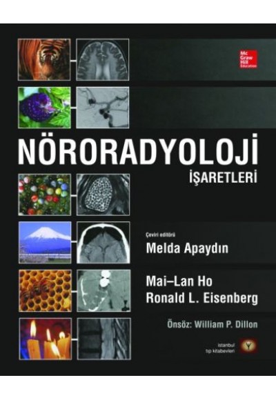 Nöroradyoloji İşaretleri (Ciltli)