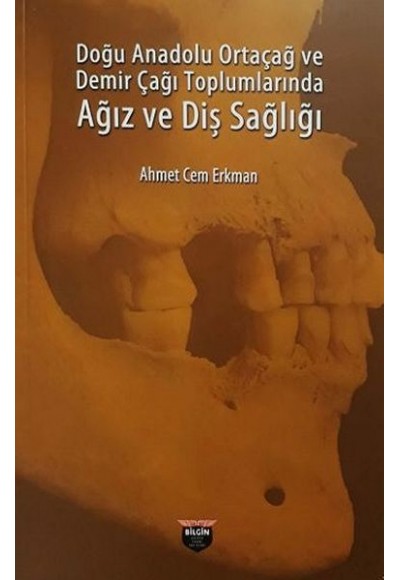 Doğu Anadolu Ortaçağ ve Demir Çağı Toplumlarında Ağız ve Diş Sağlığı